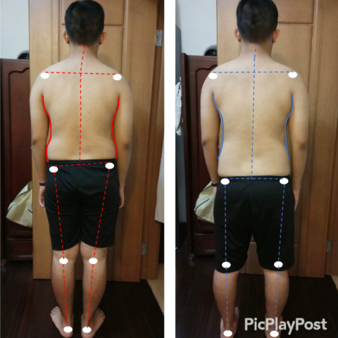 這張照片是一個關於姿勢矯正前後的對比圖。照片裡的人在矯正後，脊椎變得筆直，肩膀也變得更挺了。