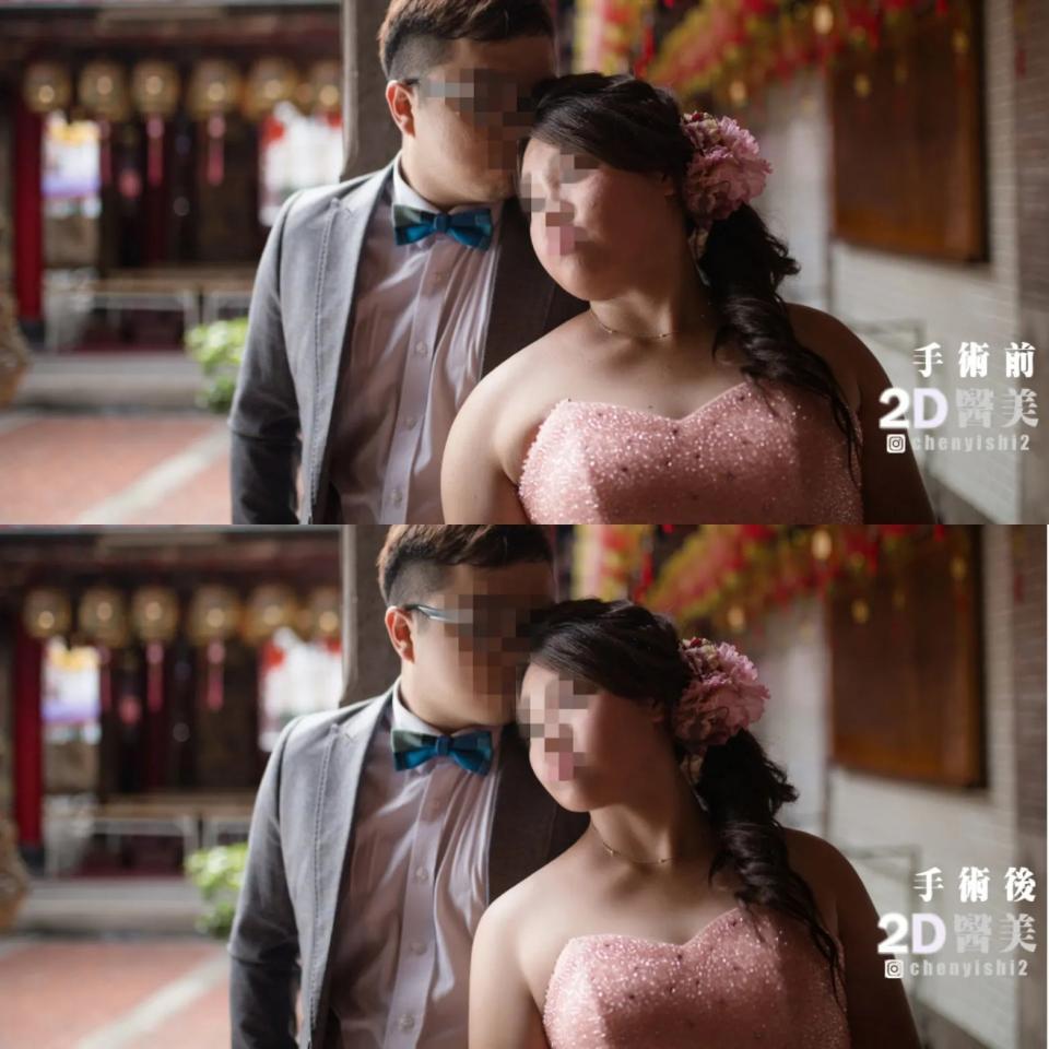 這張照片是一對新人在戶外拍婚紗照。新娘穿著粉紅色的禮服,頭上戴著白色頭紗,新郎穿著灰色西裝,頭上戴著領結,兩人依偎在一起,看起來非常甜蜜。