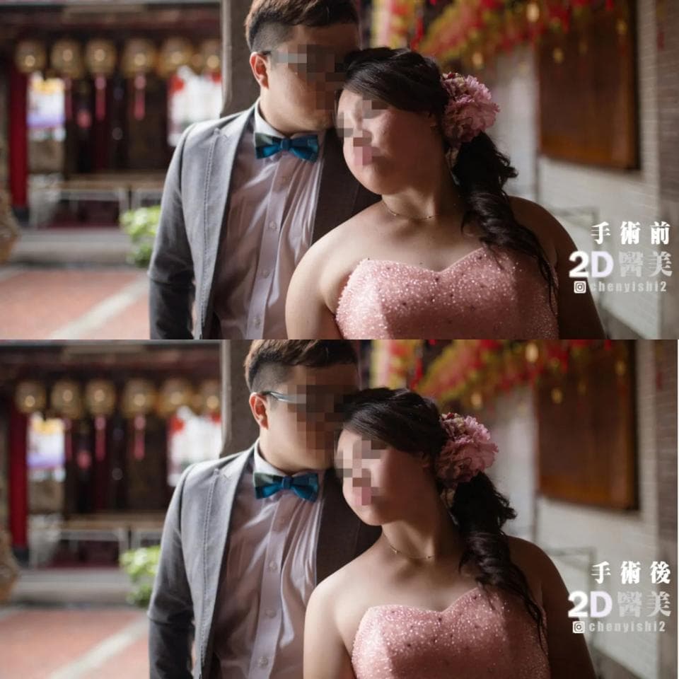 這張照片是一對新人結婚的畫像,畫面上方有一個紅色的圓形,上面寫著囍字,象徵著新人的喜悅和幸福。