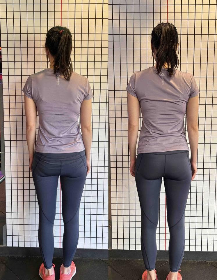 這張照片是一名女性在牆上做體態矯正的前後對比圖。她通過矯正改善了她的駝背和骨盆前傾問題,姿勢更加挺拔。