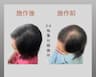small_image